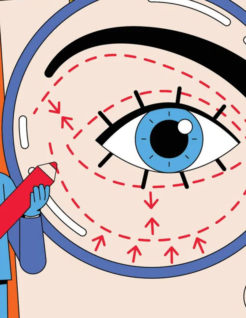 surgery-oculoplastics